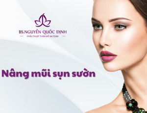 Nâng mũi sụn sườn