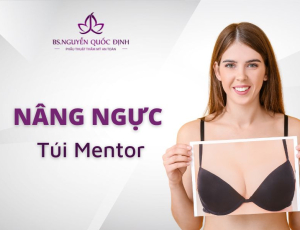 Nâng ngực túi Mentor